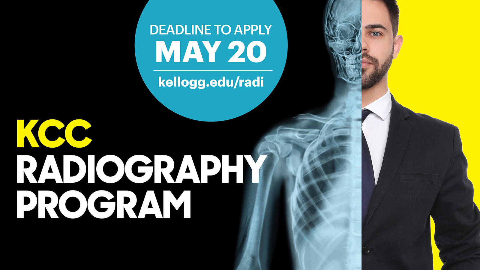 Man in a suit with half his body appearing as an X-ray skeleton, with text that reads, "KCC Radiography Program. Deadline to apply May 20. Kellogg.edu/radi."